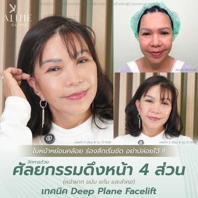 บริการหรือผลลัพธ์ที่ได้