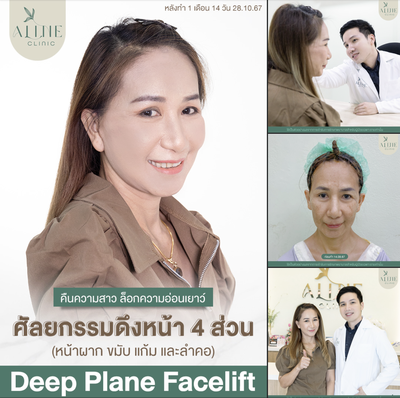 บริการหรือผลลัพธ์ที่ได้