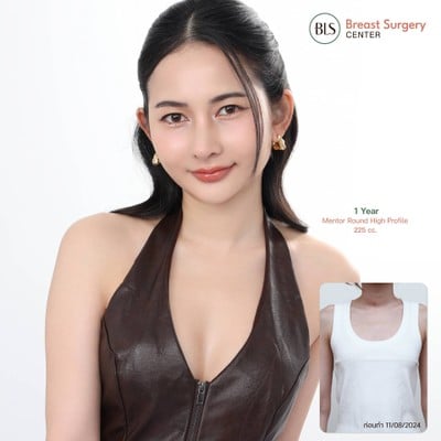 BLS Surgery Center