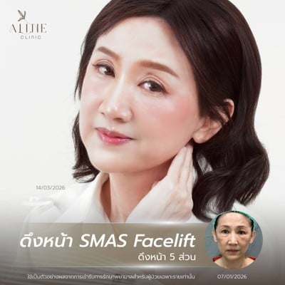 ALINE Clinic by หมอภูวิช ดึงหน้า เสริมจมูกโอเพ่น ตาสองชั้น โคราช