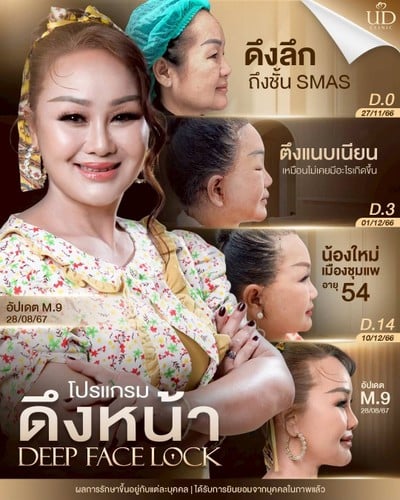 UD CLINIC รัชดา สุทธิสาร ทางออก MRT ประตู 4