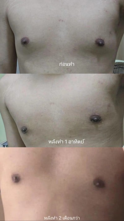 บริการหรือผลลัพธ์ที่ได้