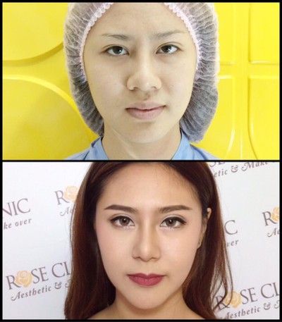 Mew Clinic ศัลยกรรม เชียงใหม่  เชียงใหม่