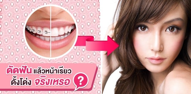 ดัดฟันแล้วหน้าเรียว ดั้งโด่ง จริงเหรอ?
