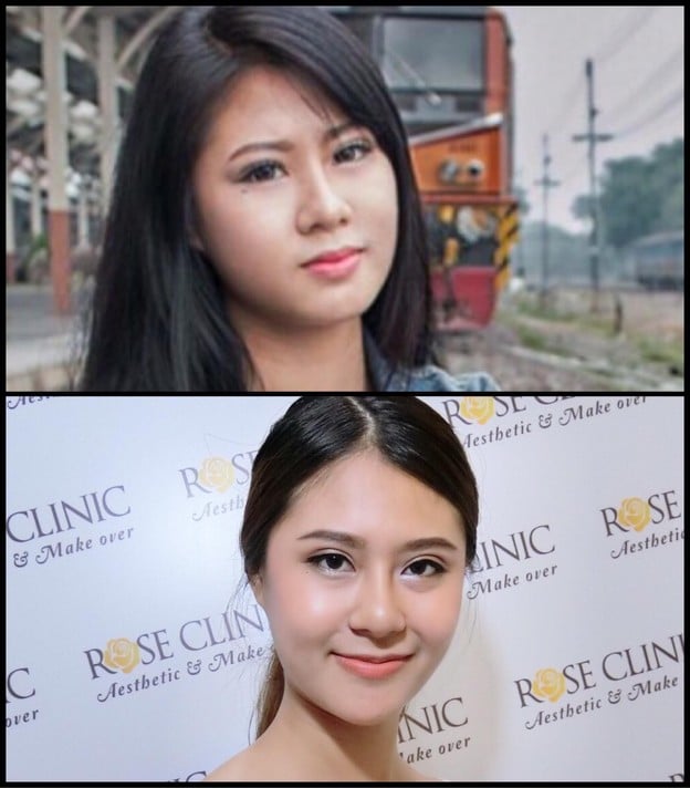 Mew Clinic ศัลยกรรม เชียงใหม่  เชียงใหม่
