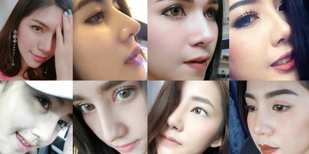 แนะนำคลินิกเสริมจมูก "ทรงสวยมาก" ในราคาเบ๊าเบาา!