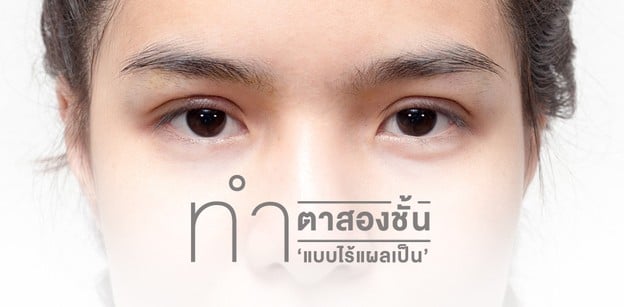 ทำตาสองชั้น ‘ไร้แผลเป็น’ ให้จับผิดไม่ได้