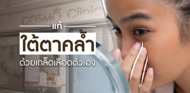 แก้ใต้ตาดำ ตาคล้ำ ด้วยเกล็ดเลือดตัวเอง