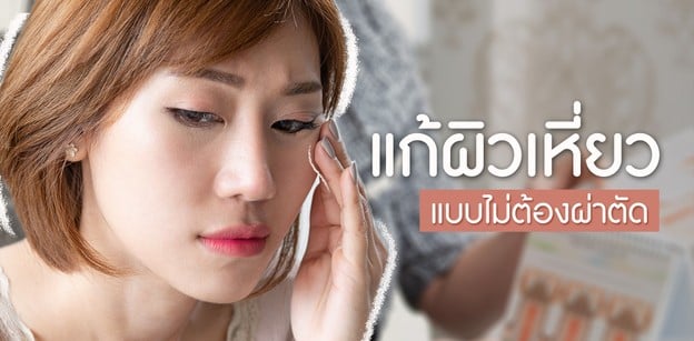 รีวิว แก้ผิวเหี่ยว แบบไม่ต้องผ่าตัด