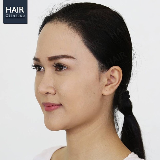 Hair Clinique