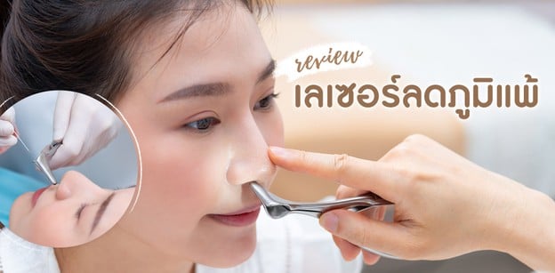 รีวิว ลดภูมิแพ้ “ด้วยเลเซอร์” @ยศการ คลินิก