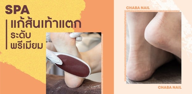 พาไปดู สปาแก้ส้นเท้าแตกระดับพรีเมียม​ 