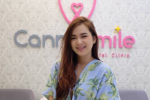 คลินิกทันตกรรมแคนนี่สไมล์