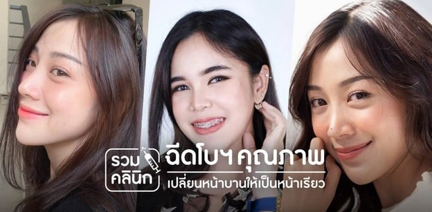  รวมคลินิกฉีดโบทูลินั่ม ท็อกคุณภาพ เปลี่ยนหน้าบานให้กลายเป็นหน้าเรียว 