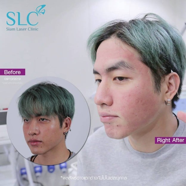 SLC Siam Laser Clinic เซ็นทรัลพลาซา ปิ่นเกล้า
