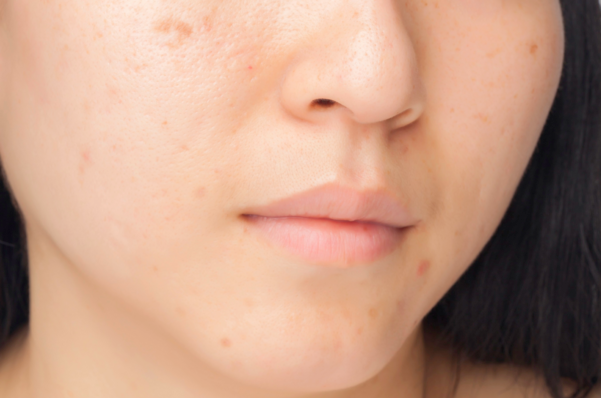 Asoke Skin Hospital อโศก