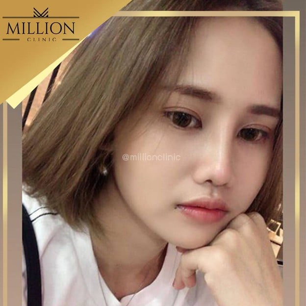 Million Clinic พัทยา