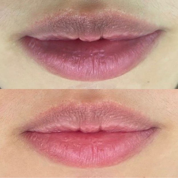 เมนูของร้าน Timeless Laser Clinic ทองหล่อ 13