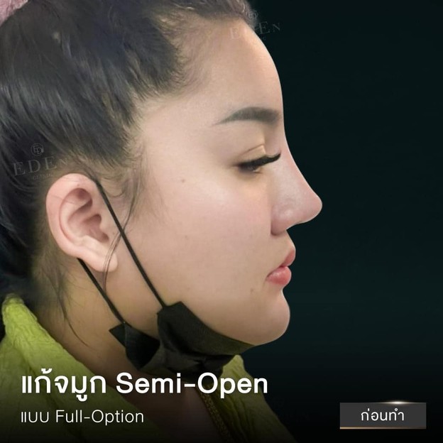 อีเดน คลีนิก E-DEn Clinic (อีเดน คลีนิก) เชียงใหม่