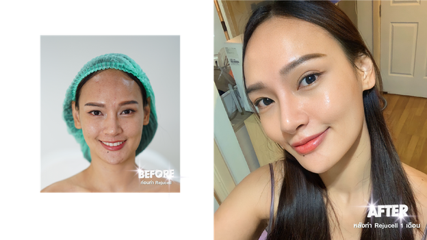 SARUNCARE CLINIC ปิ่นเกล้า