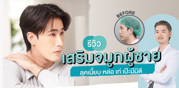 รีวิวเสริมจมูกผู้ชาย ลุคเนี้ยบ หล่อ เท่ เป๊ะมีมิติ