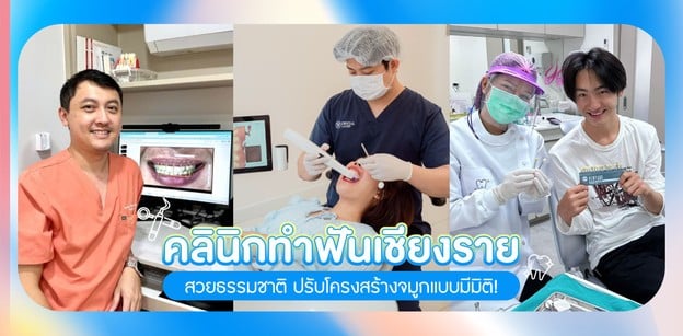 คลินิกทำฟันเชียงราย ราคาไม่แพง คุณหมอมือเบาจริง! 
