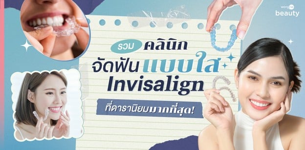 รวมคลินิกจัดฟันแบบใส Invisalign ที่ดารานิยมมากที่สุด!