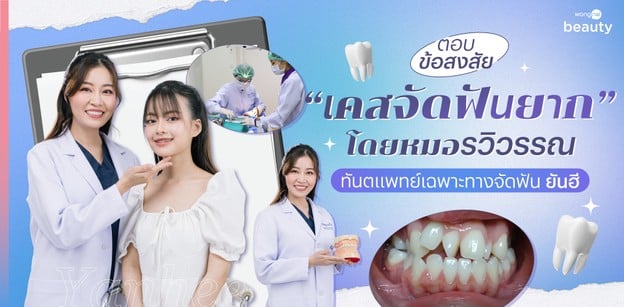 ตอบข้อสงสัย "เคสจัดฟันยาก" โดยหมอรวิวรรณ ทันตแพทย์เฉพาะทางจัดฟัน ยันฮี