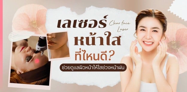 เลเซอร์หน้าใส ที่ไหนดี? ช่วยดูแลผิวหน้าให้ใสช่วงหน้าฝน