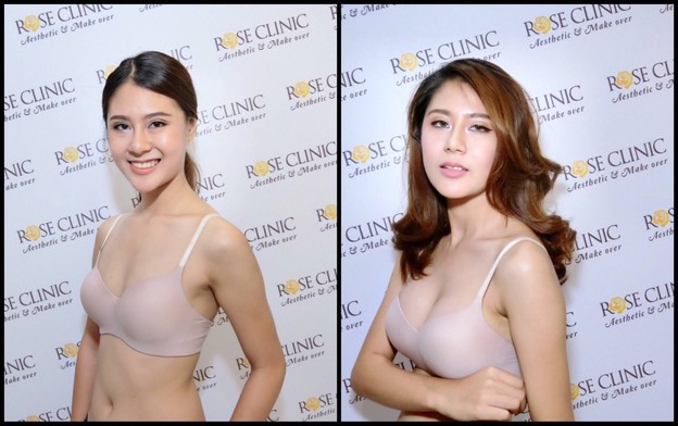 Mew Clinic ศัลยกรรม เชียงใหม่  เชียงใหม่