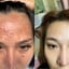M Vita Clinic - คลินิกรักษาสิว Asoke Montri