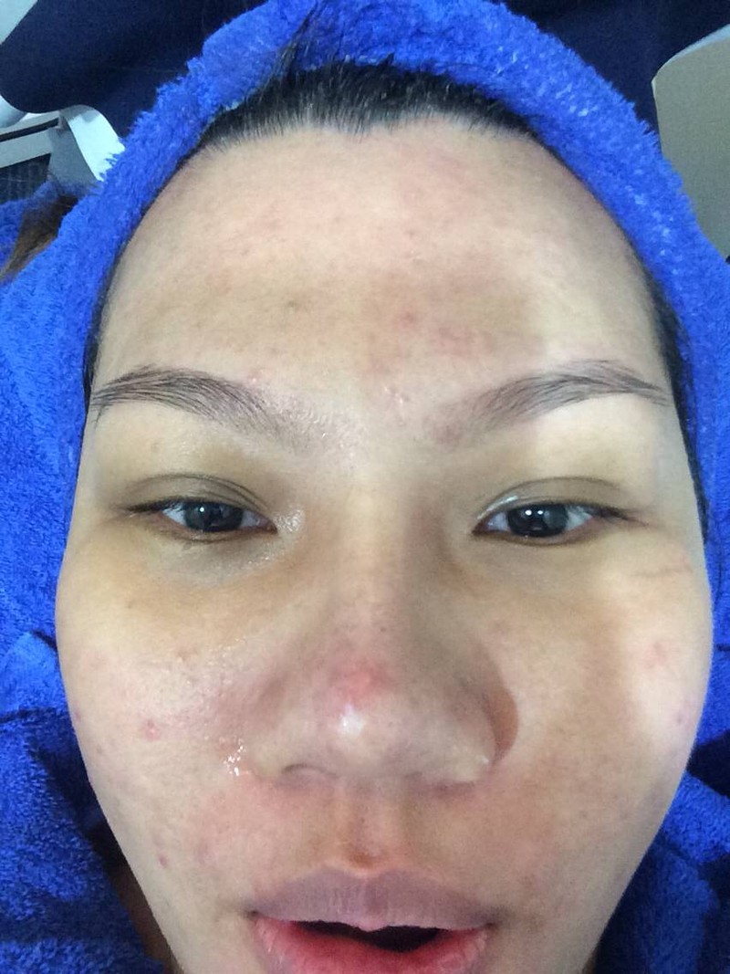 หน้าหลังทำทรีตเม้นต์ค่ะ ใสปิ๊งๆจริงๆ 