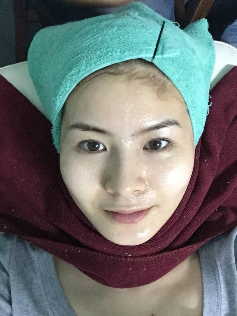 ทำ AHA หน้าใสค่ะ