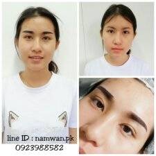 เน้นธรรมชาติ ไม่ปลิง ไม่ดำ ไม่เจ็บ 
ออกแบบให้จนกว่าจะพอใจถึงเริมสัก งานดี ค่ะ