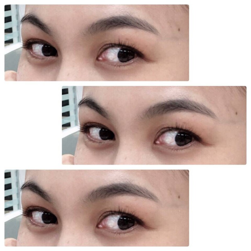lash lifting