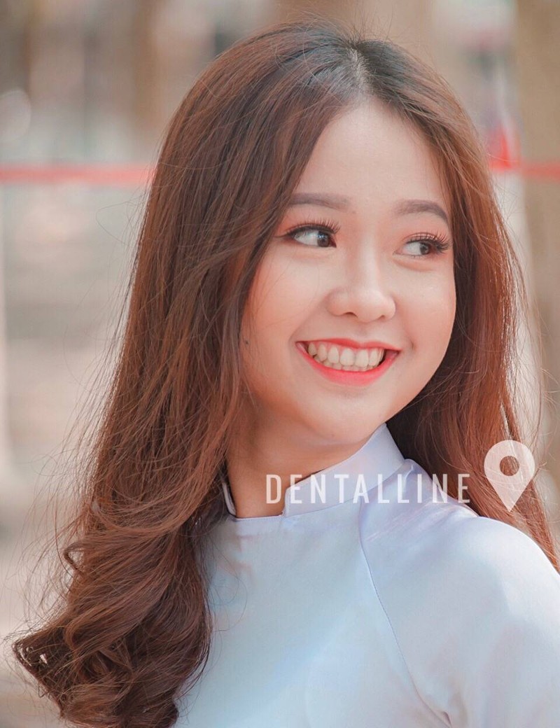 #จัดฟันเชียงใหม่ #จัดฟันลำพูน ที่ wow ที่สุด บน ถ.ซุปเปอร์ไฮเวย์เชียงใหม่-ลำปาง