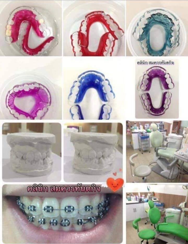 คลินิกสมควรทันตกิจ #จัดฟันคุณภาพ 0859959988