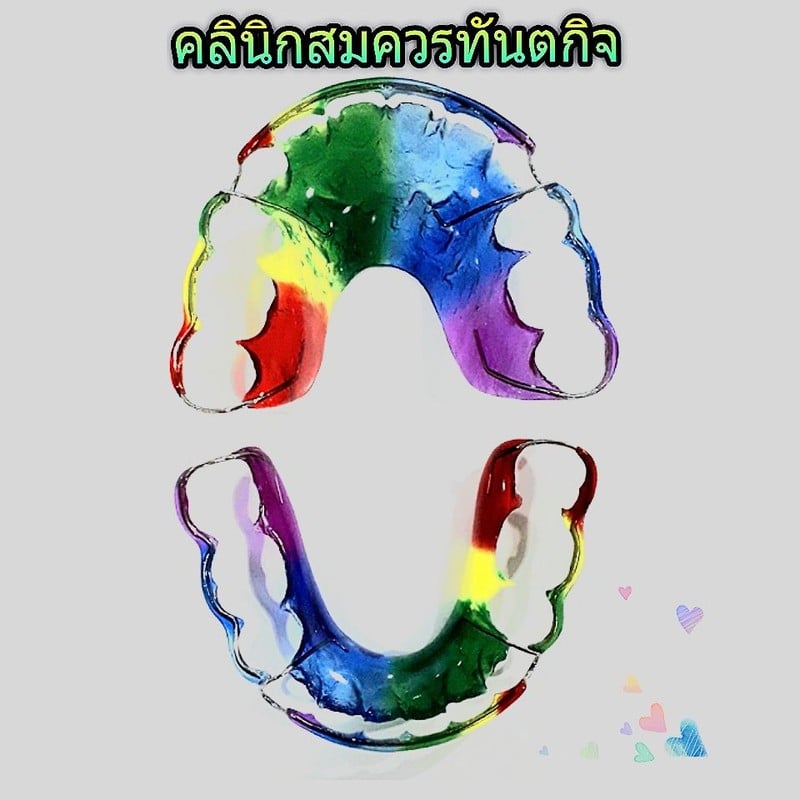 เครื่องมือคงสภาพฟัน สีสายรุ้ง#คลินิกสมควรทันตกิจ #จัดฟันปทุมธานี 0859959988