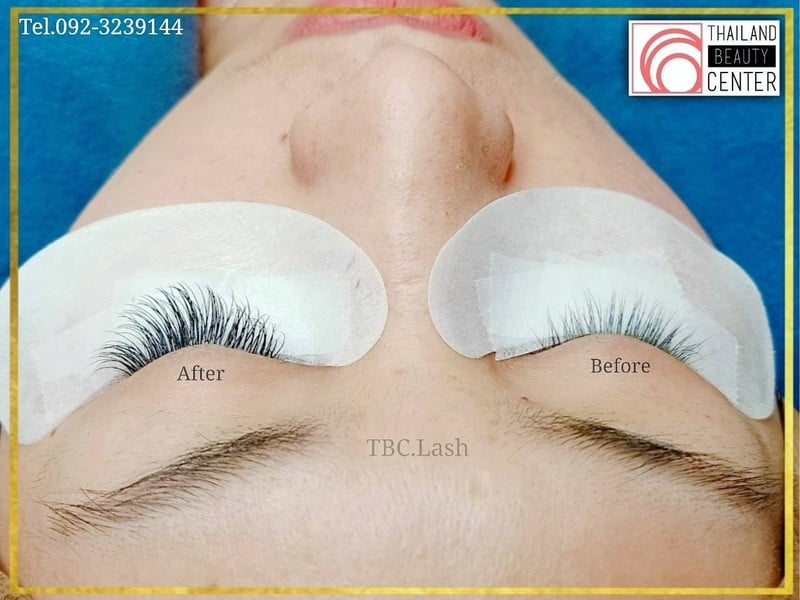 https://www.facebook.com/thailandbeautycenter9/
