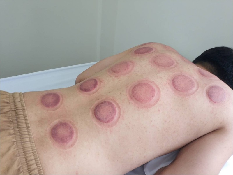 ครอบแก้ว