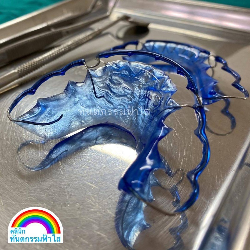 รีเทนเนอร์ สีฟ้า