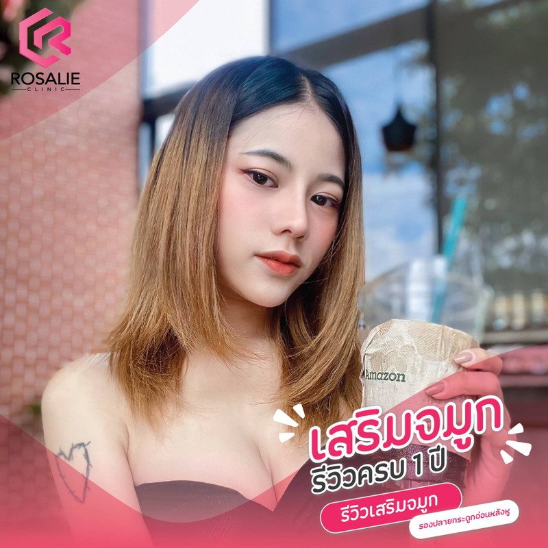 รีวิวเสริมจมูก