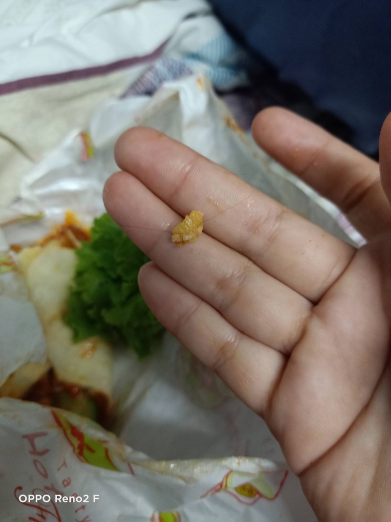 ผมยาวมาก จะอ้วก