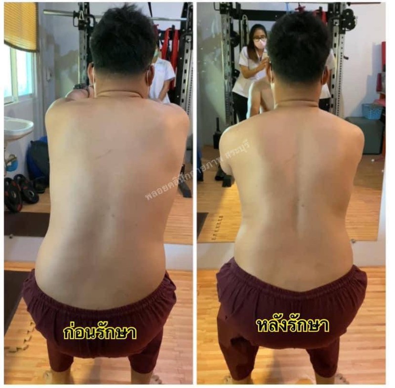 เครื่องมือทันสมัย ออกแบบท่าบริหารแก้ปวดเฉพาะราย 