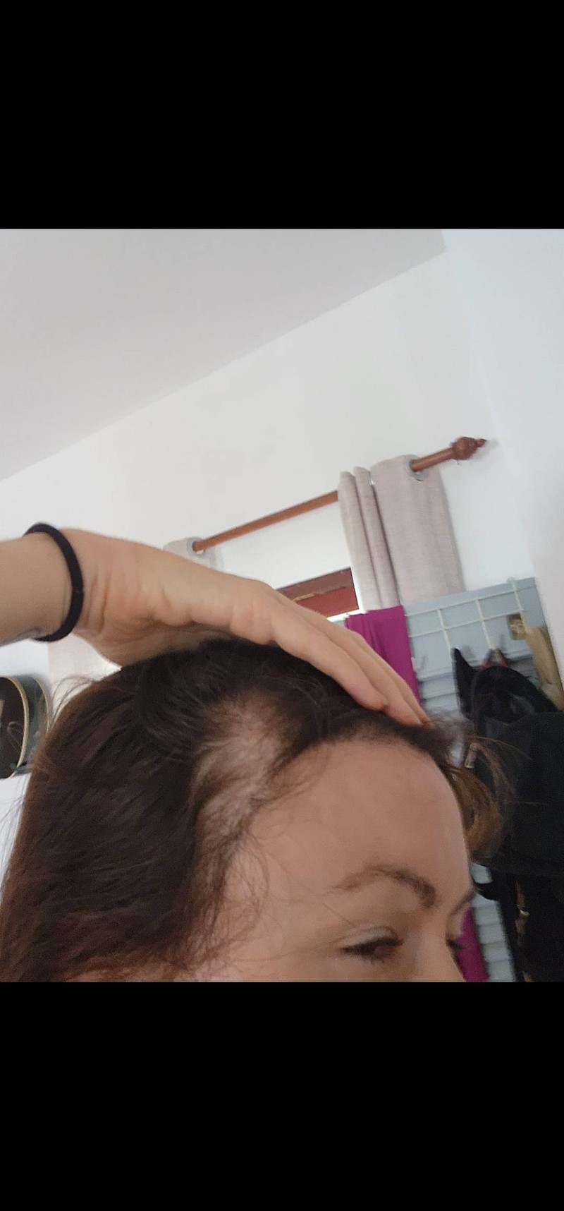 Empty patches caused by bad doctor