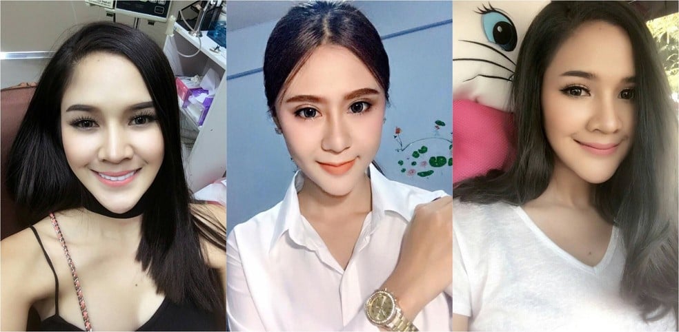 รวมพิกัด 6 คลินิกศัลยกรรมตาสองชั้นเชียงใหม่  ติดอันดับทำตาสวย