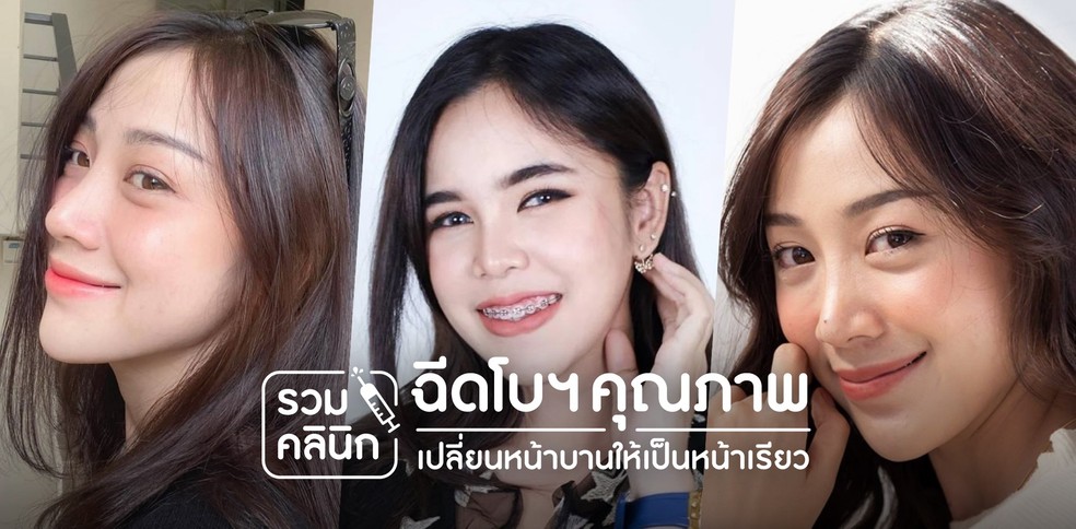 รวมคลินิกฉีดโบทูลินั่ม ท็อกคุณภาพ เปลี่ยนหน้าบานให้กลายเป็นหน้าเรียว