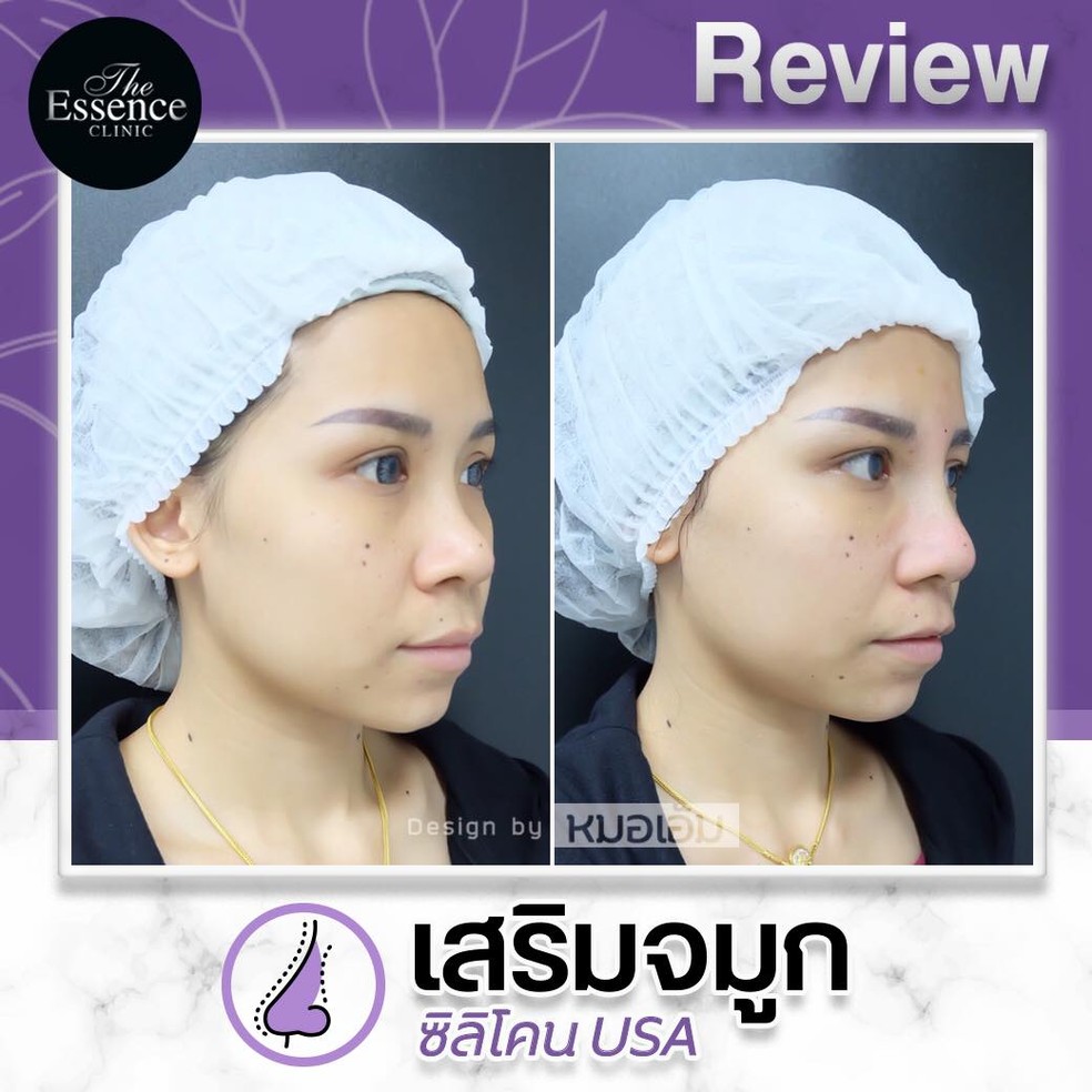The Essence Medical Clinic เชียงใหม่