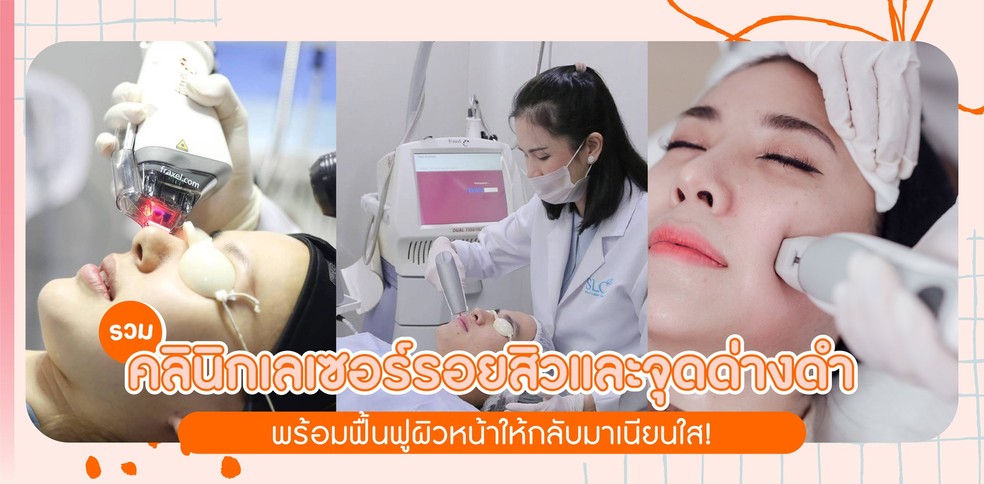 รวมคลินิกเลเซอร์รอยสิวและจุดด่างดำ พร้อมฟื้นฟูผิวหน้าให้กลับมาเนียนใส!