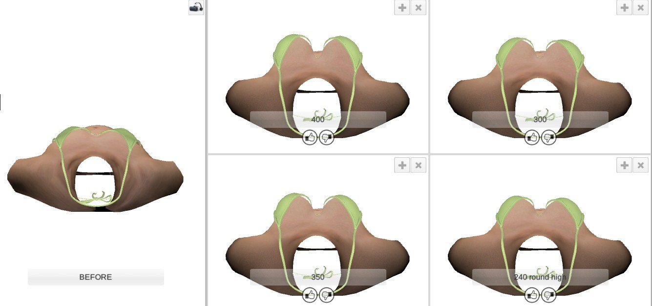 3D scanner ทำนม